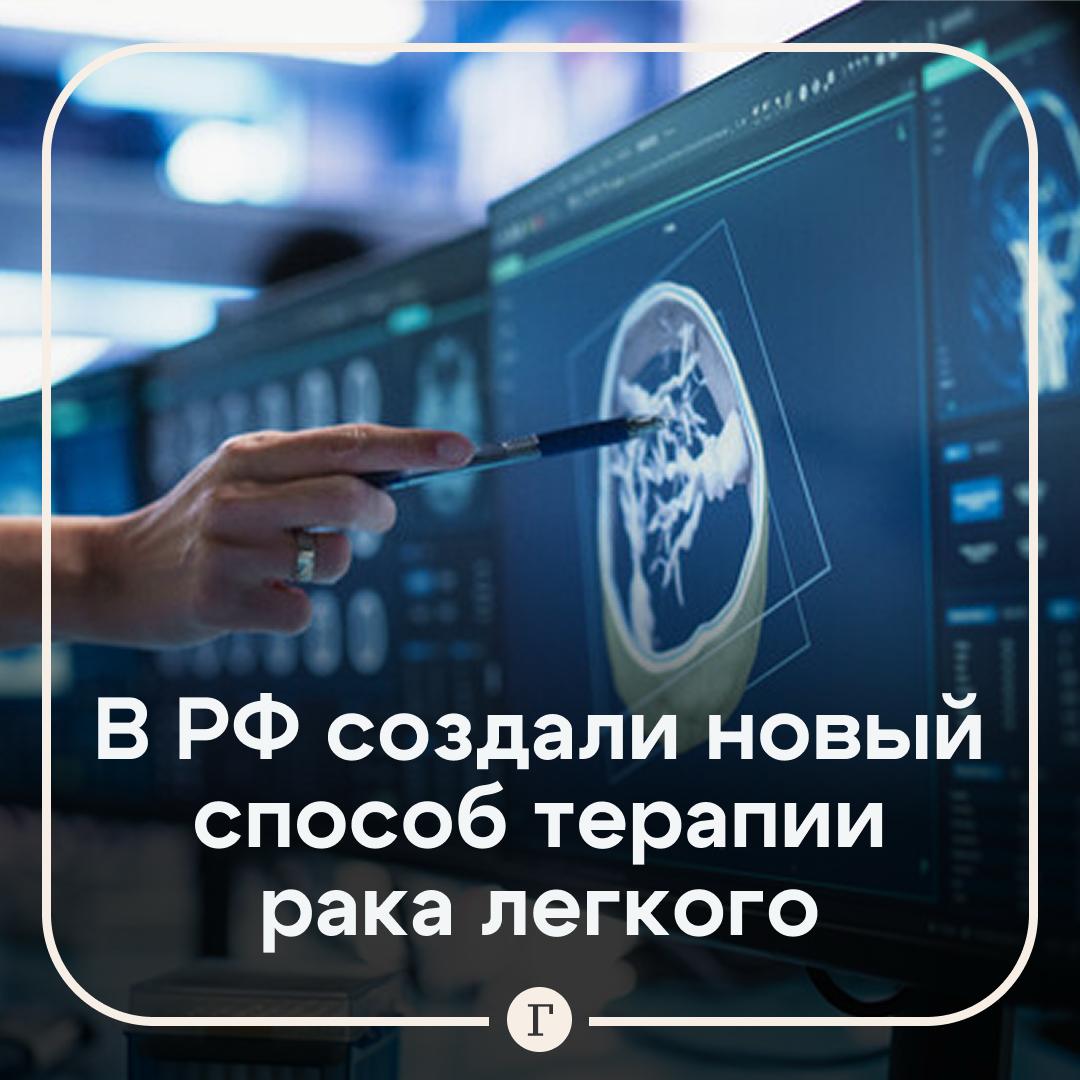 Ученые РАН создали соединения палладия для терапии рака легкого